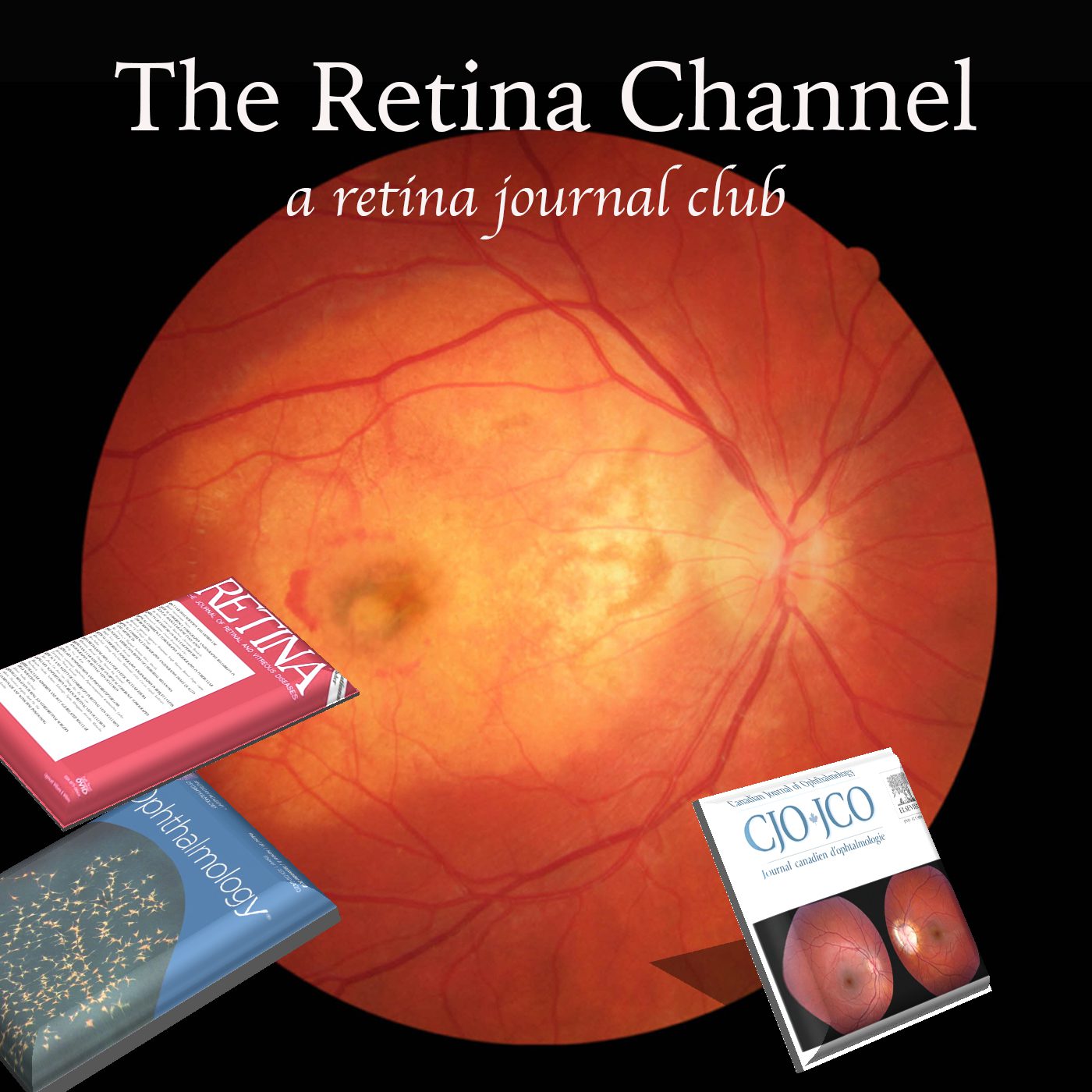 The Retina Channel Podcast